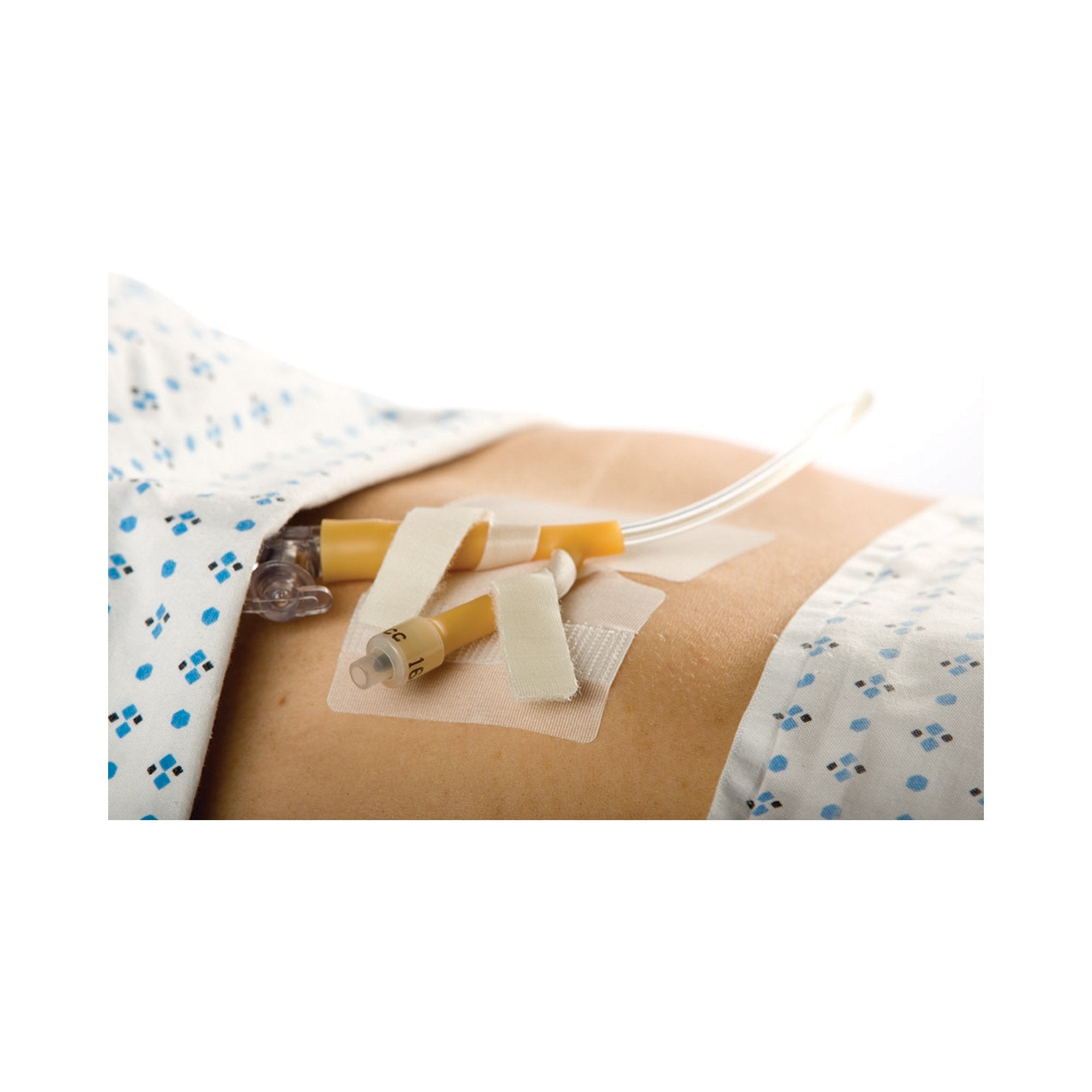 Catheter Holder Cath-Secure Dual Tab 3 Inch Wrap Tabs x 3 Inch Wide Base