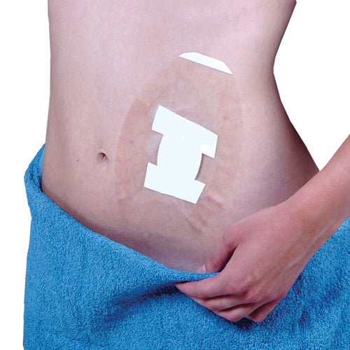 Apósito y protector de heridas Seal-tight Shield (paquete de 5)