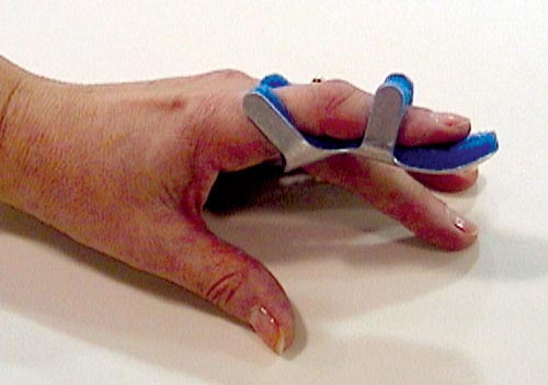 Toad Finger Splint Medium Bulk Pk/6 Non-retail