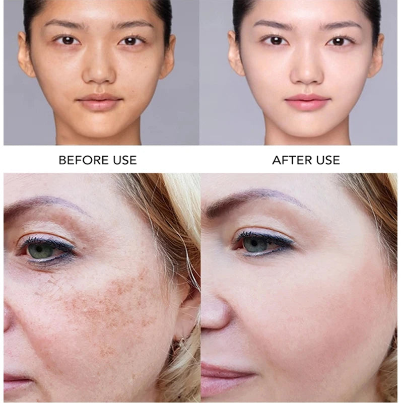 ailke super whitening face serum moisturizes hydration removes dark spots freckles chloasma with vitamin c fast results