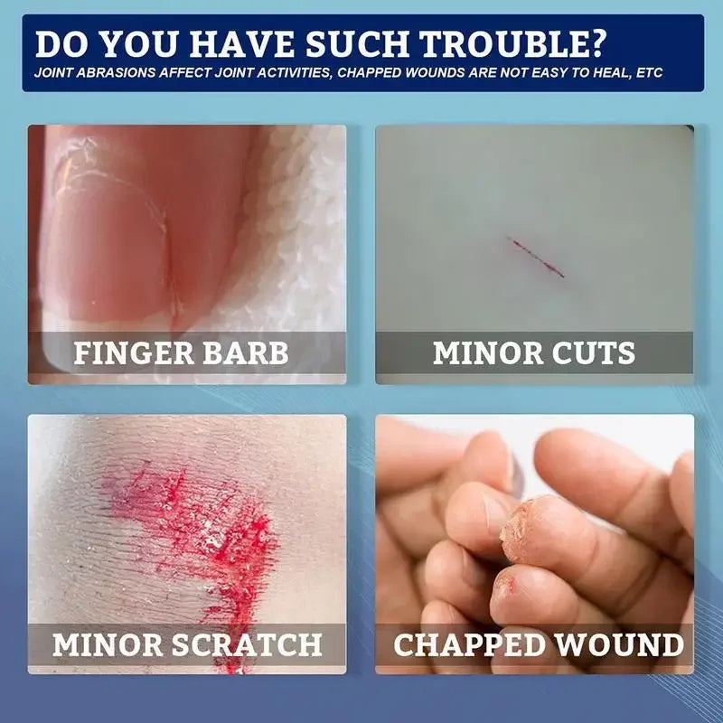 breathable and waterproof wound healing gel liquid bandage wound patch liquid band aid spray wound hemostatic glue