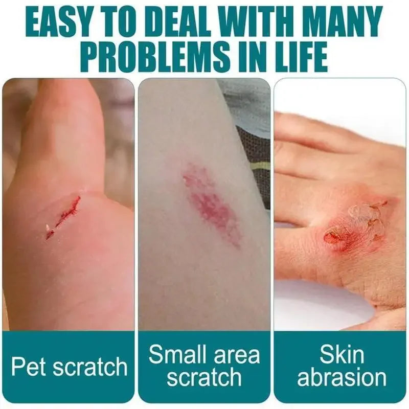 breathable and waterproof wound healing gel liquid bandage wound patch liquid band aid spray wound hemostatic glue 1