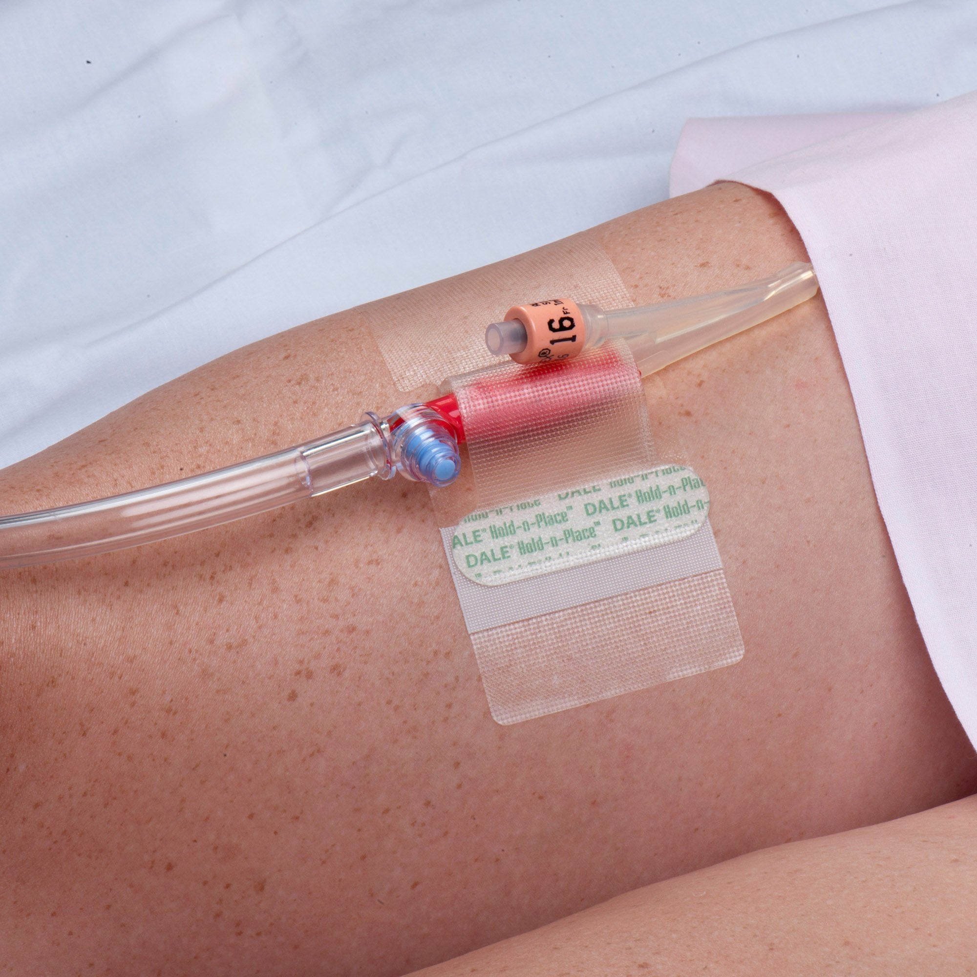 Catheter Holder Hold-n-Place One Size Fits All, Adhesive Patch