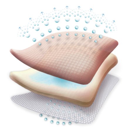 allevyn gentle border foam dressing 10 x 10 centimeter allevyn gentle border foam dressing mk834360bx