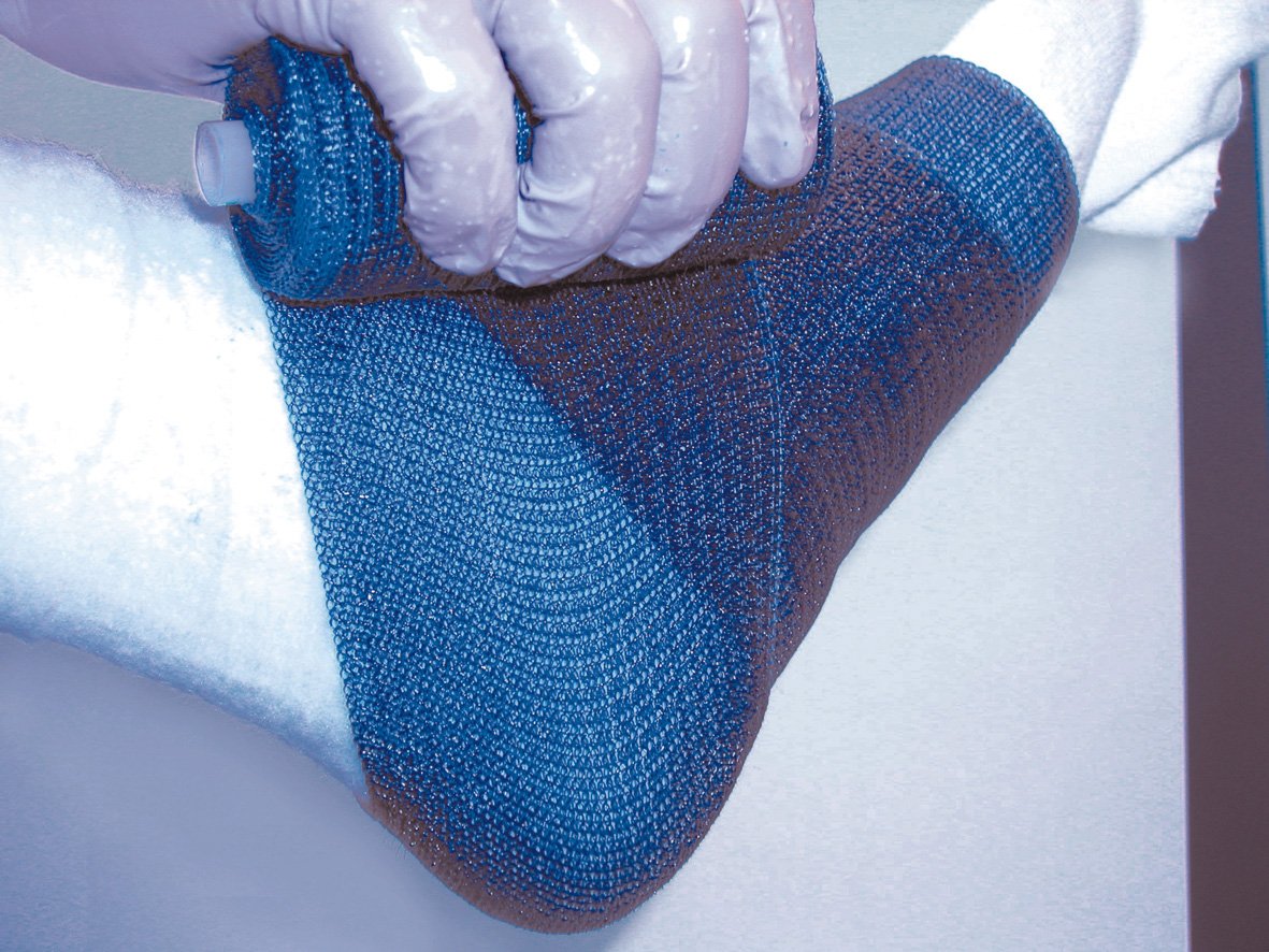 Cast Tape Delta Lite Plus 3 Inch X 12 Foot Fiberglass / Resin Light Blue