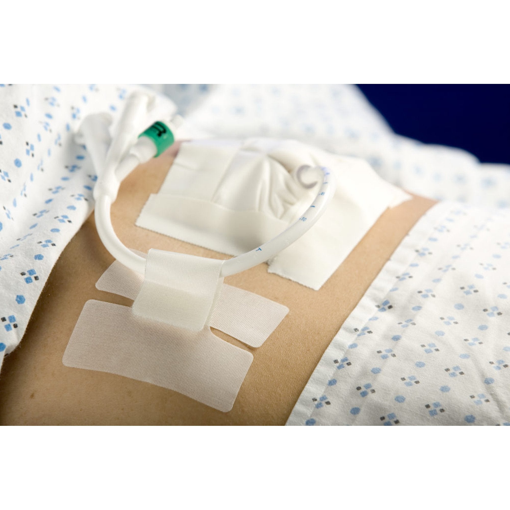 Holder, Tube Cath Secure Single Hook and Loop Tab, Hypoallergenic Tape, Butterfly Design