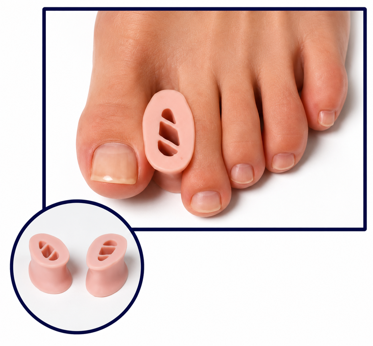 Toe Spreader Pk/12