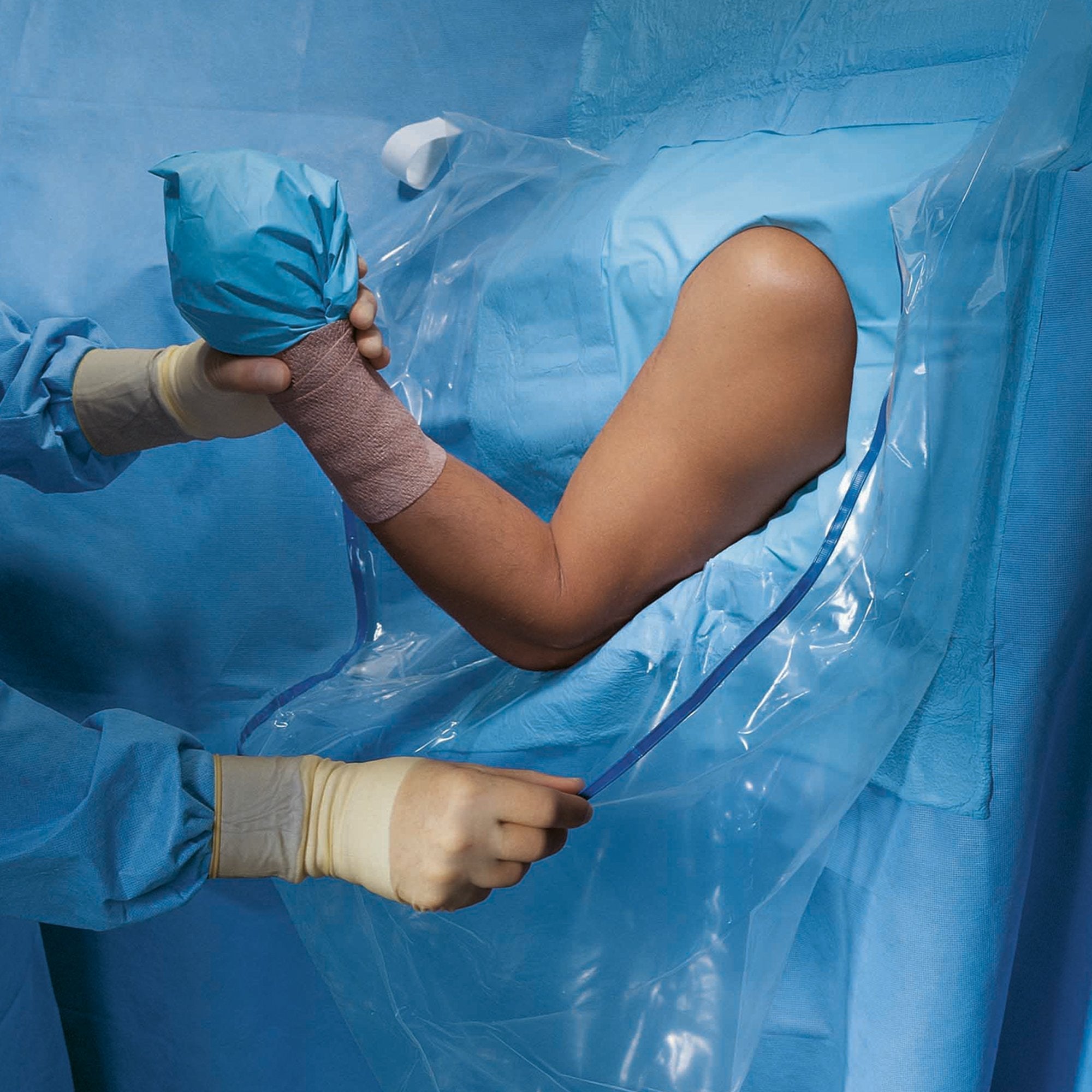 Orthopedic Drape Shoulder Arthroscopy Drape 160 W X 102 L Inch Sterile