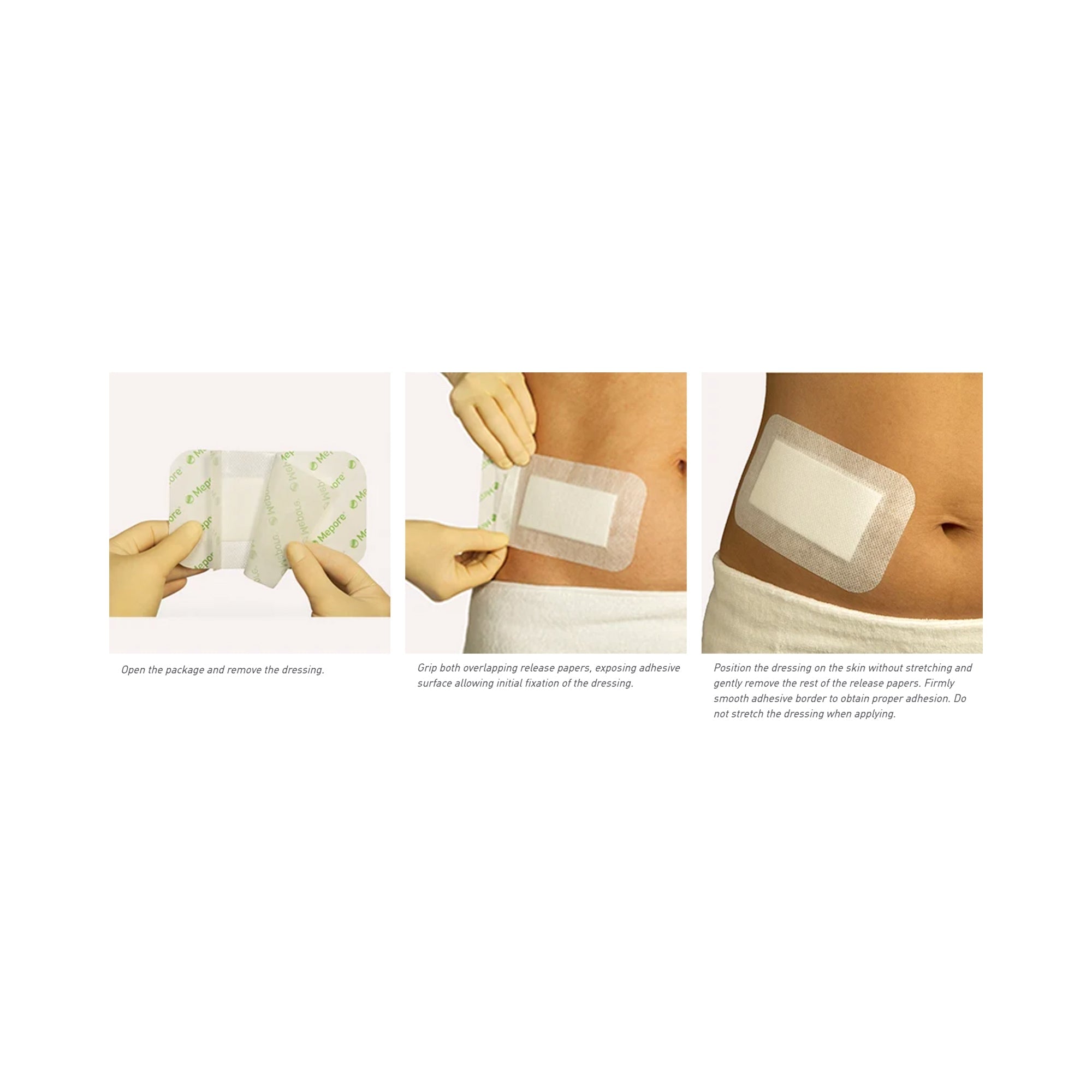 mepore adhesive dressing 3 3 5 x 6 inch mepore composite dressing mk324385bx