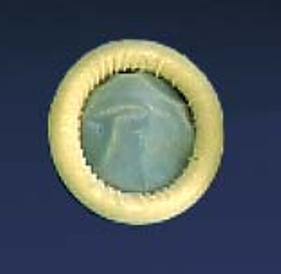 Ultrasound Probe Cover Ultra Cover 2 X 7 1/10 Inch Latex NonSterile Rolled