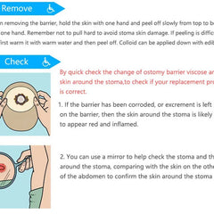 30 pcs colostomy bags disposable no leak ostomy bag comfortable stoma pouch bag non woven adults colostomy bag supplies