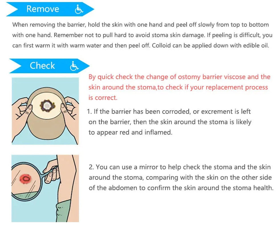 30 pcs colostomy bags disposable no leak ostomy bag comfortable stoma pouch bag non woven adults colostomy bag supplies