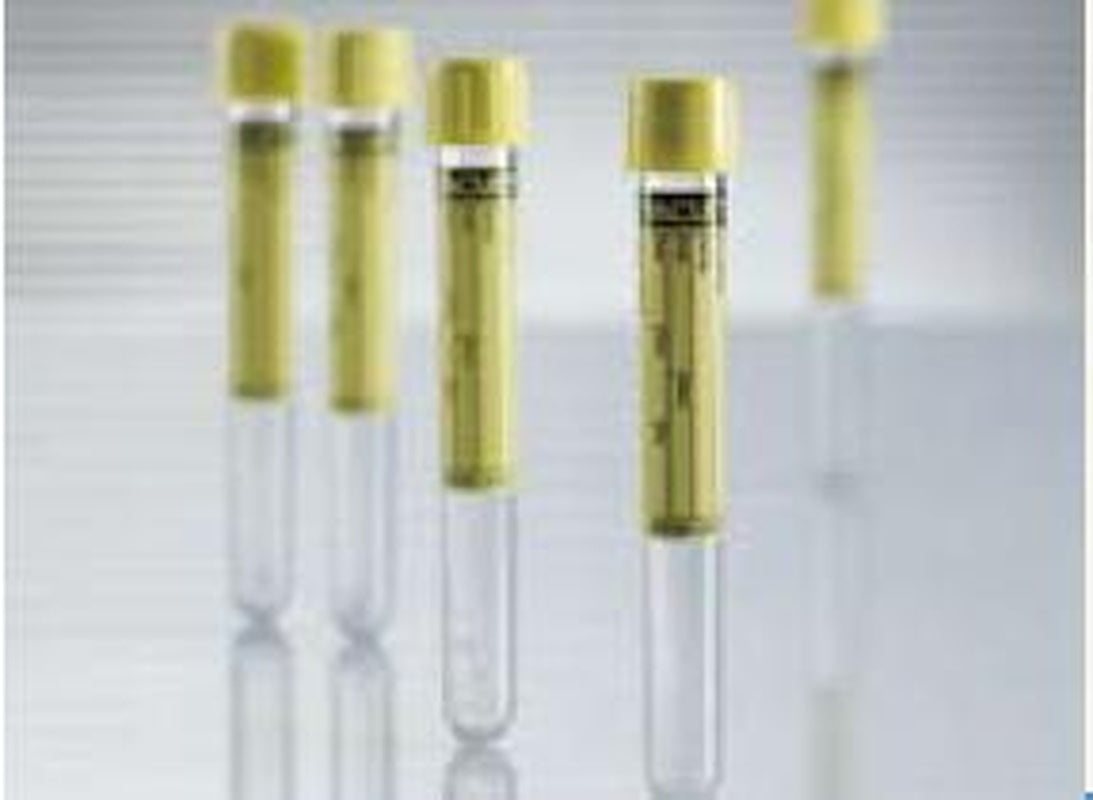 VACUETTE Urinalysis Tube Plain 6.5 mL Screw Cap Polyethylene Terephthalate (PET) Tube