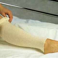 Stockinette Tubular Albahealth 3 Inch X 25 Yard Cotton NonSterile