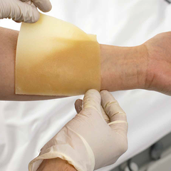 dynarex dynasafety xeroburn™ burn dressing