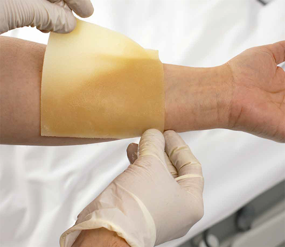 dynarex dynasafety xeroburn™ burn dressing
