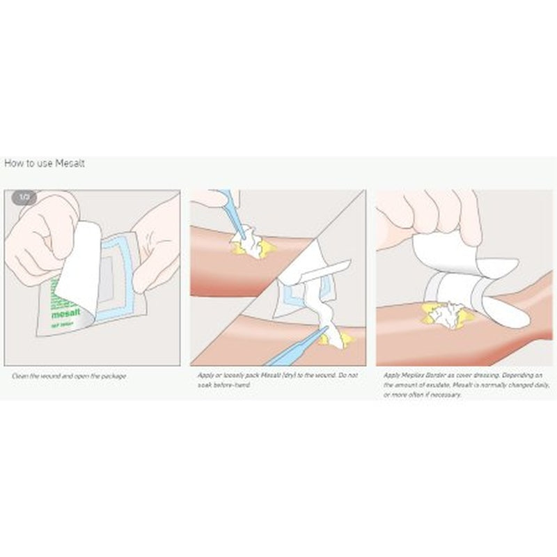 mesalt sodium chloride impregnated dressing 4 x 4 inch 2 x 2 inch folded mesalt sodium chloride impregnated dressing mk400464bx