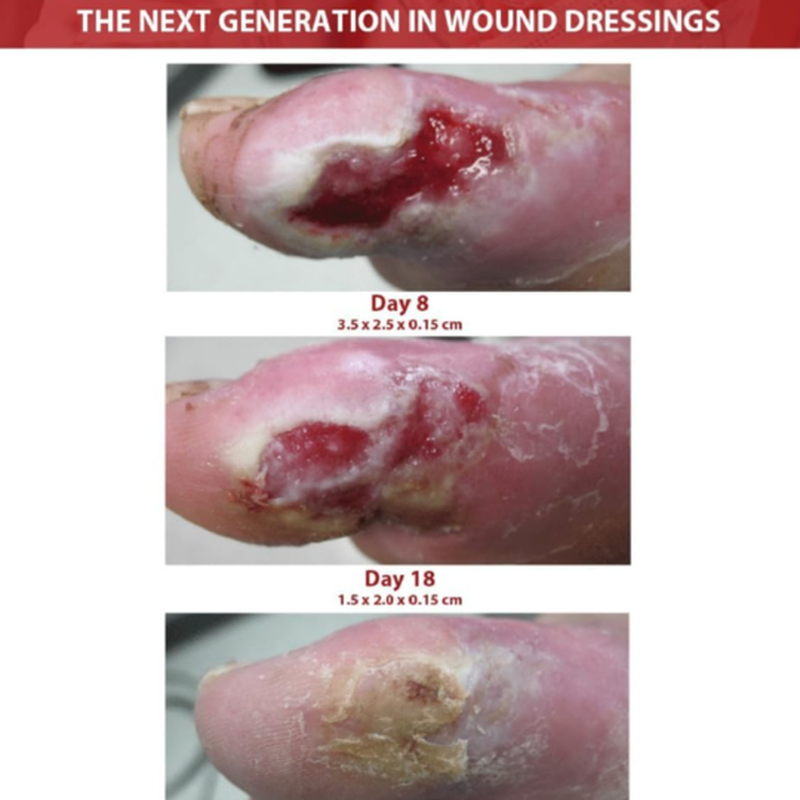 silvrstat silver gel dressing 1 oz silvrstat silver wound gel mk872359ea