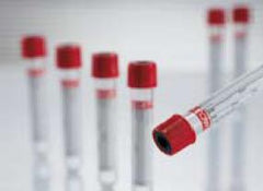 VACUETTE Z Serum Sep Clot Activator Venous Blood Collection Tube Clot Activator / Separator Gel Additive 7 mL Pull Cap Polyethylene Terephthalate (PET) Tube