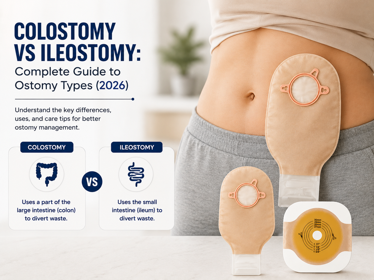 Colosotomy