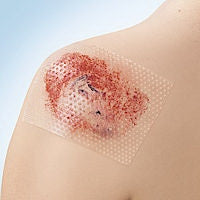 wound contact layer dressing cuticell contact 3 x 4 inch sterile