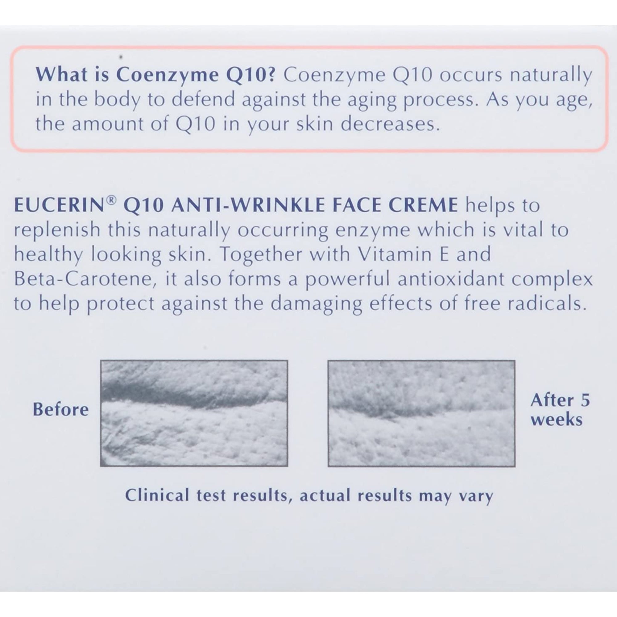 Facial Moisturizer Eucerin Q10 Anti-Wrinkle Sensitive Skin 1.7 oz. Jar Unscented Cream,Packaging Type- Each