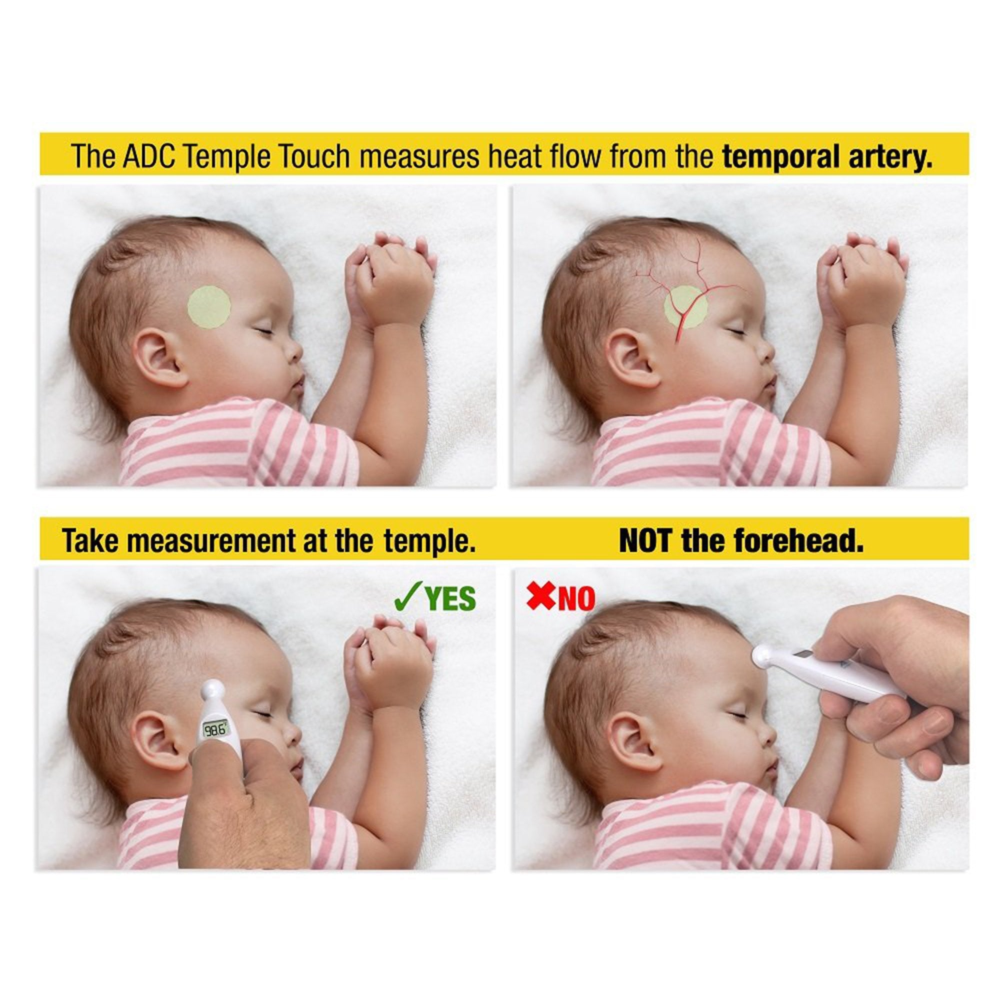Temporal Contact Thermometer Adtemp 427 Temporal Probe Handheld,Packaging Type- Each