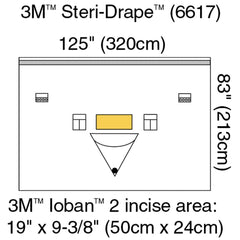 Orthopedic Drape 3M Steri Drape Isolation Drape with Incise and Pouch 125 W X 83 L Inch Sterile