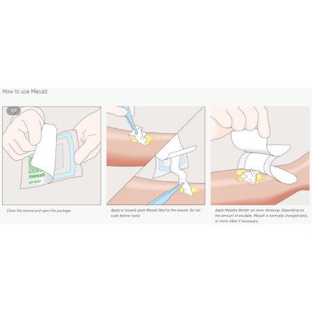 Sodium Chloride Impregnated Dressing Mesalt Square 4 X 4 Inch / 2 X 2 Inch Folded Sterile,Packaging Type- Box