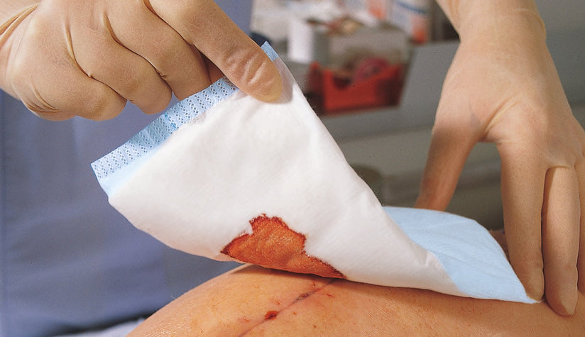 Abdominal Pad Sorbalux ABD 7-1/2 X 8 Inch 1-Ply Sterile 1 per Pouch,Packaging Type- Box