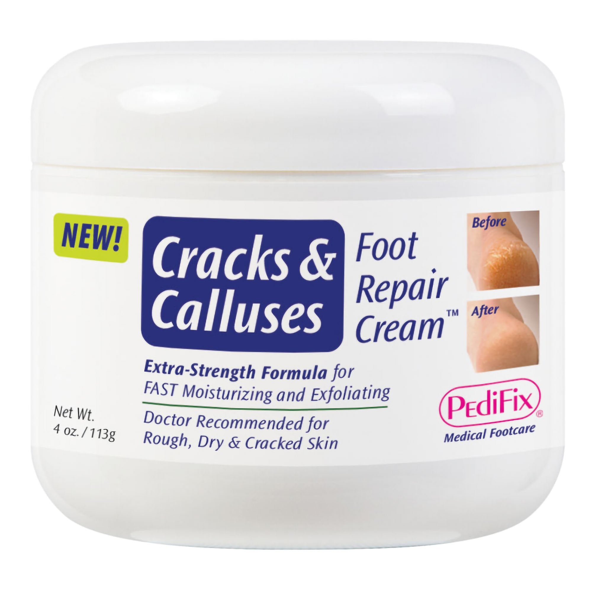 Foot Moisturizer PediFix Cracks & Calluses 4 oz. Jar Scented Cream