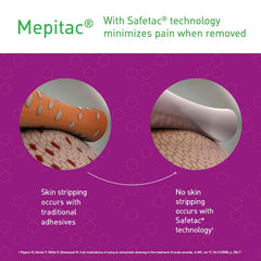 Medical Tape Mepitac Tan 3/4 X 118 Inch Silicone NonSterile | 12PK/Case