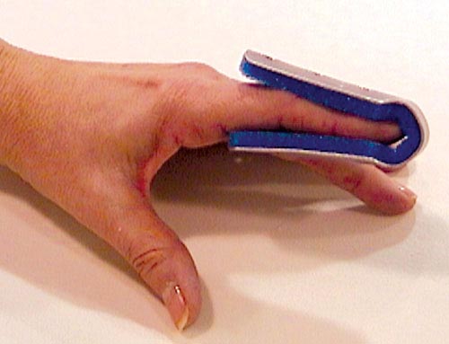 Fold Over Finger Splint Small Bulk  Pk/6 Non-retail