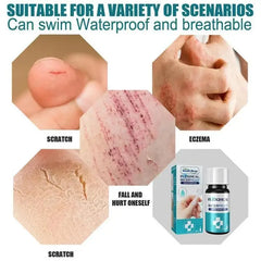 breathable and waterproof wound healing gel liquid bandage wound patch liquid band aid spray wound hemostatic glue 1