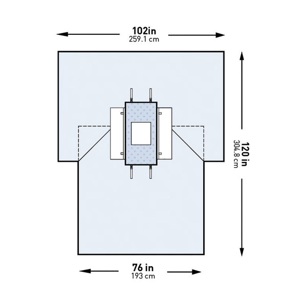 Abdominal Drape McKesson Laparotomy Drape 102 W X 76 W X 120 L Inch Sterile