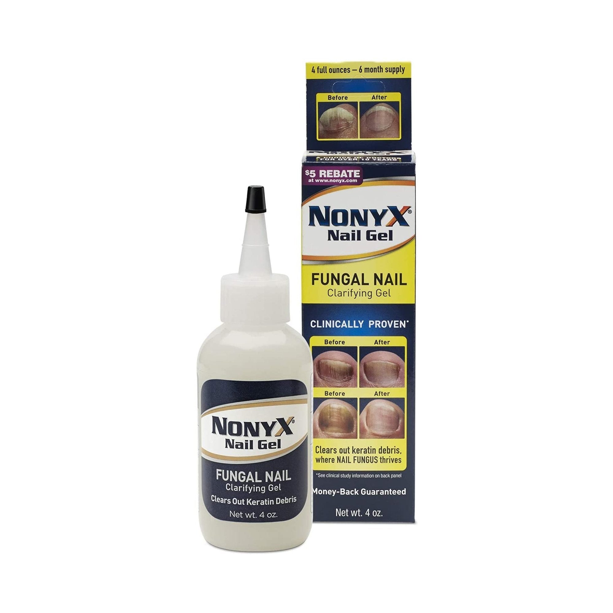 Antifungal NonyX Gel 4 oz. Bottle