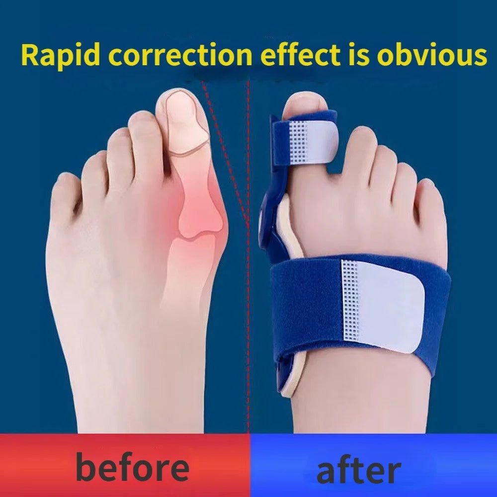 1Pc/2Pcs Big Bone Toe Bunion Splint Straightener Corrector Foot Pain Relief Hallux Valgus Feet Care Protector Foot Care Tools