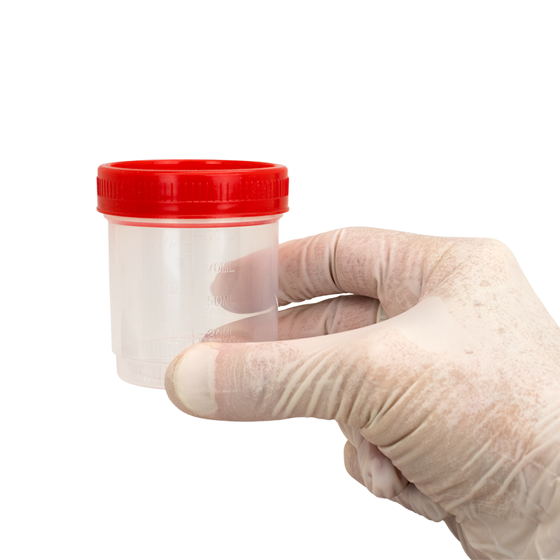 dynarex specimen containers