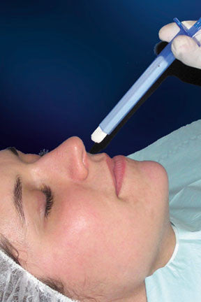Nasal Packing with Applicator Rhino Rocket Non-impregnated 1 X 3 X 5 cm Sterile (8/BX), Packaging Type- Box