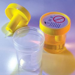 Urine Specimen Container with Integrated Transfer Device TransferTop 120 mL (4 oz.) Screw Cap Sterile, Packaging Type- Case