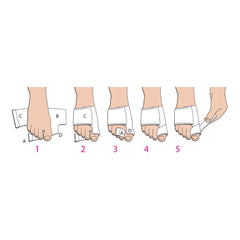 softsplint bunion splint for left foot medium softsplint bunion splint mk890216ea