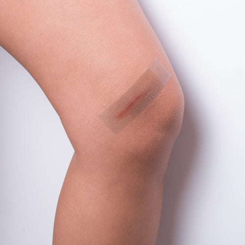 sorespot silicone tape 1 x 1 5 yd pack 1