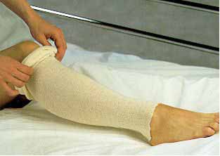 Stockinette Tubular Albahealth 3 Inch X 25 Yard Cotton NonSterile