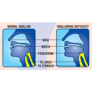 thickened water thick easy hydrolyte 4 oz portion cup lemon flavor liquid iddsi level 2 mildly thick packaging type case
