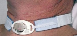 Tracheostomy Tube Holder AirLife Neonate