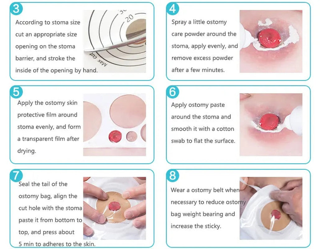 30 pcs colostomy bags disposable no leak ostomy bag comfortable stoma pouch bag non woven adults colostomy bag supplies