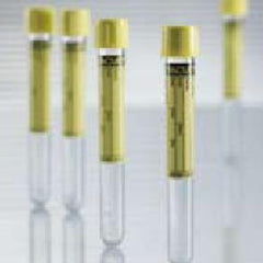 VACUETTE Urinalysis Tube Plain 9.5 mL Pull Cap Polyethylene Terephthalate (PET) Tube