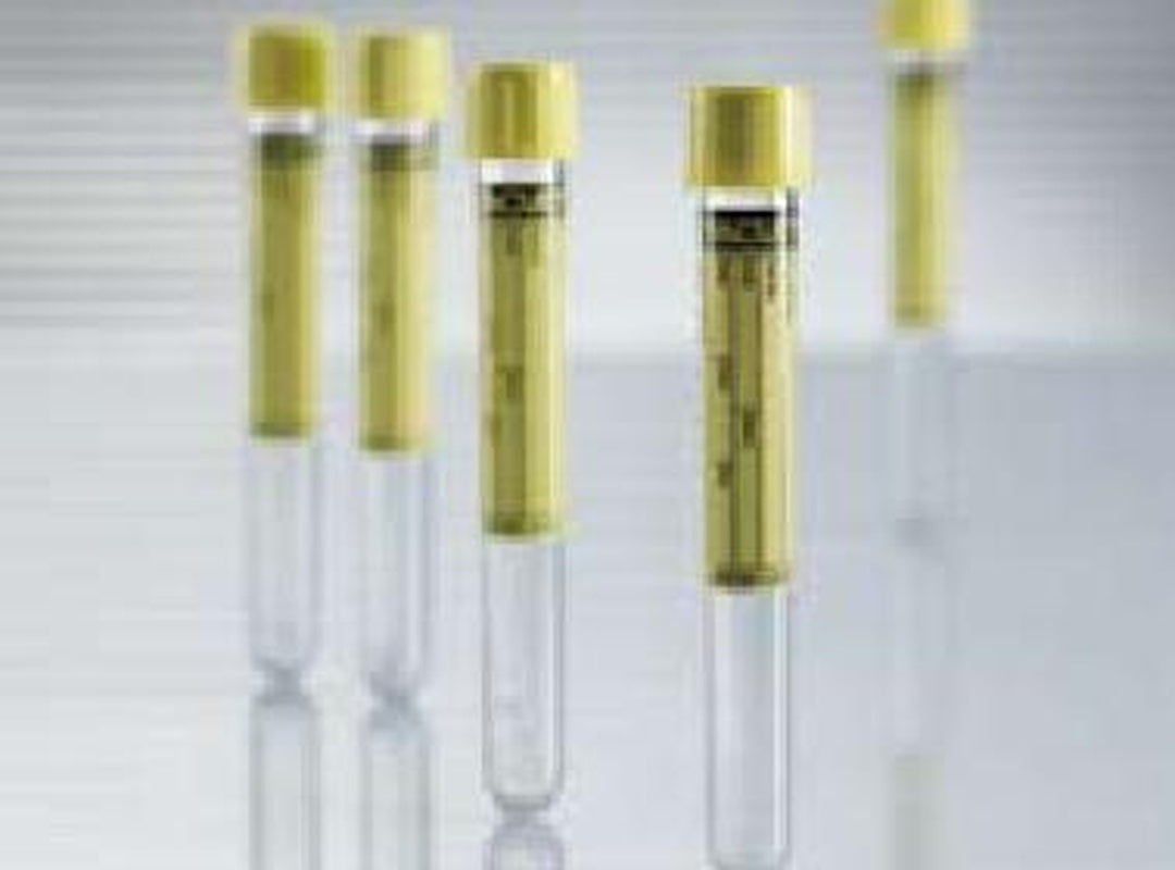 VACUETTE Urinalysis Tube Plain 9.5 mL Pull Cap Polyethylene Terephthalate (PET) Tube