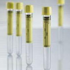VACUETTE Urinalysis Tube Plain 6.5 mL Screw Cap Polyethylene Terephthalate (PET) Tube