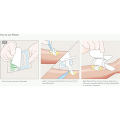 mesalt sodium chloride impregnated dressing 6 x 6 inch mesalt sodium chloride impregnated dressing mk400463bx